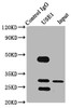 Immunoprecipitating USE1 in PC-3 whole cell lysate <br />
 Lane 1: Rabbit control IgG (1µg) instead of CSB-PA889157LA01HU in PC-3 whole cell lysate.
 For western blotting, a HRP-conjugated Protein G antibody was used as the secondary antibody (1/2000) <br />
 Lane 2: CSB-PA889157LA01HU (6µg) + PC-3 whole cell lysate (500µg) <br />
 Lane 3: PC-3 whole cell lysate (10µg) <br /> Immunoprecipitating USE1 in PC-3 whole cell lysate <br />
 Lane 1: Rabbit control IgG (1µg) instead of CSB-PA889157LA01HU in PC-3 whole cell lysate.
 For western blotting, a HRP-conjugated Protein G antibody was used as the secondary antibody (1/2000) <br />
 Lane 2: CSB-PA889157LA01HU (6µg) + PC-3 whole cell lysate (500µg) <br />
 Lane 3: PC-3 whole cell lysate (10µg) <br />