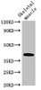 Western Blot<br />
 Positive WB detected in: Mouse skeletal muscle tissue<br />
 All lanes: ABO antibody at 3.5µg/ml<br />
 Secondary<br />
 Goat polyclonal to rabbit IgG at 1/50000 dilution<br />
 Predicted band size: 41 kDa<br />
 Observed band size: 41 kDa<br />