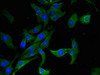 Immunofluorescent analysis of Hela cells using CSB-PA001482LA01HU at dilution of 1:100 and Alexa Fluor 488-congugated AffiniPure Goat Anti-Rabbit IgG (H+L)