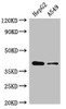 Western Blot<br />
 Positive WB detected in: HepG2 whole cell lysate, A549 whole cell lysate<br />
 All lanes: AMD1 antibody at 2.5µg/ml<br />
 Secondary<br />
 Goat polyclonal to rabbit IgG at 1/50000 dilution<br />
 Predicted band size: 39, 22 kDa<br />
 Observed band size: 39 kDa<br />