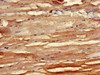 Immunohistochemistry of paraffin-embedded human skeletal muscle tissue using CSB-PA002751LA01HU at dilution of 1:100