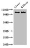 Western Blot<br />
 Positive WB detected in: Rat liver tissue, Mouse kidney tissue<br />
 All lanes: C6 antibody at 2.7µg/ml<br />
 Secondary<br />
 Goat polyclonal to rabbit IgG at 1/50000 dilution<br />
 Predicted band size: 105 kDa<br />
 Observed band size: 105 kDa<br />