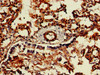 Immunohistochemistry of paraffin-embedded human lung tissue using CSB-PA004572LA01HU at dilution of 1:100