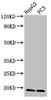 Western Blot<br />
 Positive WB detected in: HepG2 whole cell lysate, PC-3 whole cell lysate<br />
 All lanes: CAV2 antibody at 3µg/ml<br />
 Secondary<br />
 Goat polyclonal to rabbit IgG at 1/50000 dilution<br />
 Predicted band size: 19, 17, 13 kDa<br />
 Observed band size: 19 kDa<br />