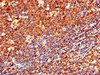 Immunohistochemistry of paraffin-embedded human tonsil tissue using CSB-PA004957LA01HU at dilution of 1:100 Immunohistochemistry of paraffin-embedded human tonsil tissue using CSB-PA004957LA01HU at dilution of 1:100