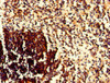 Immunohistochemistry of paraffin-embedded human spleen tissue using CSB-PA004957LA01HU at dilution of 1:100