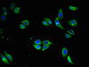 Immunofluorescent analysis of HepG2 cells using CSB-PA004957LA01HU at dilution of 1:100 and Alexa Fluor 488-congugated AffiniPure Goat Anti-Rabbit IgG (H+L) Immunofluorescent analysis of HepG2 cells using CSB-PA004957LA01HU at dilution of 1:100 and Alexa Fluor 488-congugated AffiniPure Goat Anti-Rabbit IgG (H+L)