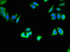 Immunofluorescent analysis of PC-3 cells using CSB-PA005057LA01HU at dilution of 1:100 and Alexa Fluor 488-congugated AffiniPure Goat Anti-Rabbit IgG (H+L) Immunofluorescent analysis of PC-3 cells using CSB-PA005057LA01HU at dilution of 1:100 and Alexa Fluor 488-congugated AffiniPure Goat Anti-Rabbit IgG (H+L)