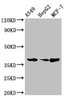 Western Blot<br />
 Positive WB detected in: A549 whole cell lysate, HepG2 whole cell lysate, MCF-7 whole cell lysate<br />
 All lanes: CEBPA antibody at 2µg/ml<br />
 Secondary<br />
 Goat polyclonal to rabbit IgG at 1/50000 dilution<br />
 Predicted band size: 38, 36, 26, 42 kDa<br />
 Observed band size: 38 kDa<br />