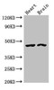 Western Blot<br />
 Positive WB detected in: Rat heart tissue, Mouse brain tissue<br />
 All lanes: CTH antibody at 4µg/ml<br />
 Secondary<br />
 Goat polyclonal to rabbit IgG at 1/50000 dilution<br />
 Predicted band size: 45, 40, 42 kDa<br />
 Observed band size: 45 kDa<br />