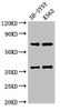 Western Blot<br />
 Positive WB detected in: SH-SY5Y whole cell lysate, K562 whole cell lysate<br />
 All lanes: CTSH antibody at 2.7µg/ml<br />
 Secondary<br />
 Goat polyclonal to rabbit IgG at 1/50000 dilution<br />
 Predicted band size: 38 kDa<br />
 Observed band size: 38 kDa<br />