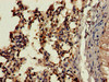 Immunohistochemistry of paraffin-embedded human lung tissue using CSB-PA006191LA01HU at dilution of 1:100