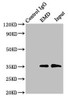 Immunoprecipitating EMD in Hela whole cell lysate<br />
 Lane 1: Rabbit control IgG instead of (1µg) instead of CSB-PA007633LA01HU in Hela whole cell lysate.
 For western blotting, a HRP-conjugated Protein G antibody was used as the secondary antibody (1/2000) <br />
 Lane 2: CSB-PA007633LA01HU (8µg) + Hela whole cell lysate (500µg) <br />
 Lane 3: Hela whole cell lysate (10µg) <br />