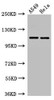 Western Blot<br />
 Positive WB detected in: A549 whole cell lysate, Hela whole cell lysate<br />
 All lanes: EPHA5 antibody at 3µg/ml<br />
 Secondary<br />
 Goat polyclonal to rabbit IgG at 1/50000 dilution<br />
 Predicted band size: 115, 113, 108 kDa<br />
 Observed band size: 115 kDa<br /> Western Blot<br />
 Positive WB detected in: A549 whole cell lysate, Hela whole cell lysate<br />
 All lanes: EPHA5 antibody at 3µg/ml<br />
 Secondary<br />
 Goat polyclonal to rabbit IgG at 1/50000 dilution<br />
 Predicted band size: 115, 113, 108 kDa<br />
 Observed band size: 115 kDa<br />