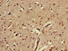 Immunohistochemistry of paraffin-embedded human brain tissue using CSB-PA007725LA01HU at dilution of 1:100 Immunohistochemistry of paraffin-embedded human brain tissue using CSB-PA007725LA01HU at dilution of 1:100