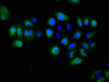 Immunofluorescent analysis of A549 cells using CSB-PA007725LA01HU at dilution of 1:100 and Alexa Fluor 488-congugated AffiniPure Goat Anti-Rabbit IgG (H+L) Immunofluorescent analysis of A549 cells using CSB-PA007725LA01HU at dilution of 1:100 and Alexa Fluor 488-congugated AffiniPure Goat Anti-Rabbit IgG (H+L)