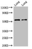 Western Blot<br />
 Positive WB detected in: Rat lung tissue, Mouse lung tissue<br />
 All lanes: HTR3A antibody at 2.5µg/ml<br />
 Secondary<br />
 Goat polyclonal to rabbit IgG at 1/50000 dilution<br />
 Predicted band size: 56, 59, 54, 60 kDa<br />
 Observed band size: 56 kDa<br />