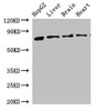 Western Blot<br />
 Positive WB detected in: HepG2 whole cell lysate, Rat liver tissue, Rat brain tissue, Mouse heart tissue<br />
 All lanes: KLKB1 antibody at 2.5µg/ml<br />
 Secondary<br />
 Goat polyclonal to rabbit IgG at 1/50000 dilution<br />
 Predicted band size: 72 kDa<br />
 Observed band size: 72 kDa<br />