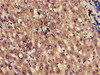 Immunohistochemistry of paraffin-embedded human liver tissue using CSB-PA012461LA01HU at dilution of 1:100