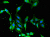Immunofluorescent analysis of Hela cells using CSB-PA013451LA01HU at dilution of 1:100 and Alexa Fluor 488-congugated AffiniPure Goat Anti-Rabbit IgG (H+L)