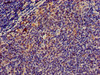 Immunohistochemistry of paraffin-embedded human lymph node tissue using CSB-PA015025LA01HU at dilution of 1:100