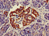 Immunohistochemistry of paraffin-embedded human pancreatic tissue using CSB-PA015025LA01HU at dilution of 1:100