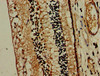 Immunohistochemistry of paraffin-embedded human eye tissue using CSB-PA015190LA01HU at dilution of 1:100