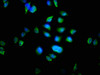 Immunofluorescence staining of Hela cells with CSB-PA015197LA01HU at 1:100, counter-stained with DAPI. The cells were fixed in 4% formaldehyde, permeabilized using 0.2% Triton X-100 and blocked in 10% normal Goat Serum. The cells were then incubated with the antibody overnight at 4°C. The secondary antibody was Alexa Fluor 488-congugated AffiniPure Goat Anti-Rabbit IgG (H+L) .