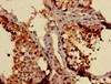 Immunohistochemistry of paraffin-embedded human testis tissue using CSB-PA015645LA01HU at dilution of 1:100
