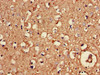 Immunohistochemistry of paraffin-embedded human brain tissue using CSB-PA016070LA01HU at dilution of 1:100