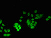 Immunofluorescent analysis of PC-3 cells using CSB-PA016154LA01HU at dilution of 1:100 and Alexa Fluor 488-congugated AffiniPure Goat Anti-Rabbit IgG (H+L)