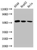Western Blot<br />
 Positive WB detected in: A549 whole cell lysate, HepG2 whole cell lysate, Hela whole cell lysate<br />
 All lanes: ONECUT2 antibody at 2.4µg/ml<br />
 Secondary<br />
 Goat polyclonal to rabbit IgG at 1/50000 dilution<br />
 Predicted band size: 55 kDa<br />
 Observed band size: 55 kDa<br />
