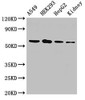 Western Blot<br />
 Positive WB detected in: A549 whole cell lysate, HEK293 whole cell lysate, HepG2 whole cell lysate, Rat kidney tissue<br />
 All lanes: P4HA1 antibody at 2.5µg/ml<br />
 Secondary<br />
 Goat polyclonal to rabbit IgG at 1/50000 dilution<br />
 Predicted band size: 62, 61, 59 kDa<br />
 Observed band size: 62 kDa<br />