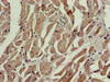 Immunohistochemistry of paraffin-embedded human heart tissue using CSB-PA017339LA01HU at dilution of 1:100