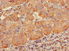 Immunohistochemistry of paraffin-embedded human adrenal gland tissue using CSB-PA017687LA01HU at dilution of 1:100