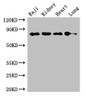 Western Blot<br />
 Positive WB detected in: Raji whole cell lysate, Mouse kidney tissue, Rat heart tissue, Rat lung tissue<br />
 All lanes: PECAM1 antibody at 2.7µg/ml<br />
 Secondary<br />
 Goat polyclonal to rabbit IgG at 1/50000 dilution<br />
 Predicted band size: 83, 81, 80, 82 kDa<br />
 Observed band size: 83 kDa<br />