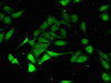 Immunofluorescent analysis of Hela cells using CSB-PA018867LA01HU at dilution of 1:100 and Alexa Fluor 488-congugated AffiniPure Goat Anti-Rabbit IgG (H+L)