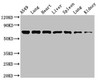 Western Blot<br />
 Positive WB detected in: A549 whole cell lysate, Rat lung tissue, Mouse heart tissue, Mouse liver tissue, Mouse spleen tissue, Mouse lung tissue, Mouse kidney tissue<br />
 All lanes: RPA1 antibody at 3.4µg/ml<br />
 Secondary<br />
 Goat polyclonal to rabbit IgG at 1/50000 dilution<br />
 Predicted band size: 69 kDa<br />
 Observed band size: 69 kDa<br />