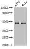Western Blot<br />
 Positive WB detected in: A375 whole cell lysate, Hela whole cell lysate<br />
 All lanes: RPL4 antibody at 2µg/ml<br />
 Secondary<br />
 Goat polyclonal to rabbit IgG at 1/50000 dilution<br />
 Predicted band size: 48 kDa<br />
 Observed band size: 48 kDa<br />