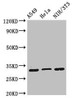 Western Blot<br />
 Positive WB detected in: A549 whole cell lysate, Hela whole cell lysate, NIH/3T3 whole cell lysate<br />
 All lanes: RPS2 antibody at 2µg/ml<br />
 Secondary<br />
 Goat polyclonal to rabbit IgG at 1/50000 dilution<br />
 Predicted band size: 32 kDa<br />
 Observed band size: 32 kDa<br />