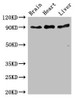 Western Blot<br />
 Positive WB detected in: Mouse brain tissue, Rat heart tissue, Rat liver tissue<br />
 All lanes: RPS6KA5 antibody at 3µg/ml<br />
 Secondary<br />
 Goat polyclonal to rabbit IgG at 1/50000 dilution<br />
 Predicted band size: 90, 62, 82 kDa<br />
 Observed band size: 90 kDa<br />