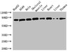 Western Blot<br />
 Positive WB detected in: HepG2 whole cell lysate, A549 whole cell lysate, Hela whole cell lysate, Mouse skeletal muscle tissue, Mouse liver tissue, Rat heart tissue, Rat liver tissue, Rat thymus tissue<br />
 All lanes: SKIL antibody at 1.6µg/ml<br />
 Secondary<br />
 Goat polyclonal to rabbit IgG at 1/50000 dilution<br />
 Predicted band size: 77, 47, 72, 45, 75 kDa<br />
 Observed band size: 77 kDa<br />