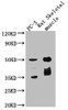 Western Blot<br />
 Positive WB detected in: Mouse stomach tissue, Mouse skeletal muscle tissue<br />
 All lanes: SLC16A3 antibody at 3µg/ml<br />
 Secondary<br />
 Goat polyclonal to rabbit IgG at 1/50000 dilution<br />
 Predicted band size: 50 kDa<br />
 Observed band size: 50 kDa<br />
