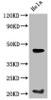 Western Blot<br />
 Positive WB detected in: Mouse heart tissue<br />
 All lanes: WNT5A antibody at 3µg/ml<br />
 Secondary<br />
 Goat polyclonal to rabbit IgG at 1/50000 dilution<br />
 Predicted band size: 43, 41 kDa<br />
 Observed band size: 43 kDa<br /> Western Blot<br />
 Positive WB detected in: Mouse heart tissue<br />
 All lanes: WNT5A antibody at 3µg/ml<br />
 Secondary<br />
 Goat polyclonal to rabbit IgG at 1/50000 dilution<br />
 Predicted band size: 43, 41 kDa<br />
 Observed band size: 43 kDa<br />