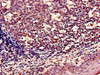 Immunohistochemistry of paraffin-embedded human tonsil tissue using CSB-PA026138LA01HU at dilution of 1:100 Immunohistochemistry of paraffin-embedded human tonsil tissue using CSB-PA026138LA01HU at dilution of 1:100