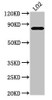 Western Blot<br />
 Positive WB detected in: LO2 whole cell lysate<br />
 All lanes: XRCC5 antibody at 3.5µg/ml<br />
 Secondary<br />
 Goat polyclonal to rabbit IgG at 1/50000 dilution<br />
 Predicted band size: 83 kDa<br />
 Observed band size: 83 kDa<br />