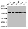 Western Blot<br />
 Positive WB detected in: MCF-7 whole cell lysate, HepG2 whole cell lysate, Jurkat whole cell ltysate, Mouse liver tissue, Rat liver tissue<br />
 All lanes: KAT8 antibody at 3µg/ml<br />
 Secondary<br />
 Goat polyclonal to rabbit IgG at 1/50000 dilution<br />
 Predicted band size: 53, 54 kDa<br />
 Observed band size: 53 kDa<br />