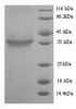 (Tris-Glycine gel) Discontinuous SDS-PAGE (reduced) with 5% enrichment gel and 15% separation gel.