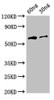 Western Blot<br />
 Positive WB detected in Recombinant protein<br />
 All lanes: HA antibody at 3µg/ml<br />
 Secondary<br />
 Goat polyclonal to rabbit IgG at 1/50000 dilution<br />
 predicted band size: 64 kDa<br />
 observed band size: 64 kDa<br />