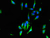 Immunofluorescent analysis of Hela cells using CSB-PA619784LA01HU at dilution of 1:100 and Alexa Fluor 488-congugated AffiniPure Goat Anti-Rabbit IgG (H+L)